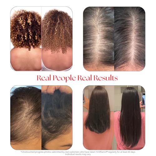 HAIRtamin Vegan Hair Vitamins for Faster Growth | All Natural Biotin Capsules to Support Healthy Hair, Skin and Nails | May Reduce Loss & Thinning | 30 Capsules (1)