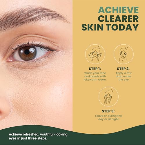 MUDMASKY Vitamin-Infused Eye Serum 30ml / 1.0 FL. OZ. - Skin Care Serum with Vitamin C & K, Reduces Dark Circles, Firms, Moisturizes, Hydrates, Restores Youthful Skin, Eye Care for All Skin Types