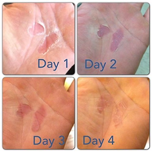 RipFix Hand Tear Repair - Rip Fix Stopper Balm for Gymnastics - Climbers Hand Balm - Wod Callus Hand Care - Climbing Hand Repair Balm Cream - Treatment for Cracked or Ripped Hands 0.3 oz - Pack of 6