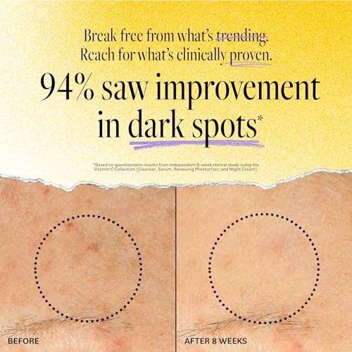 Derma E Vitamin C Brightening Cleanser - Glowing Skin with Licorice Extract, Green Tea & Glycolic Acid, 6 fl oz