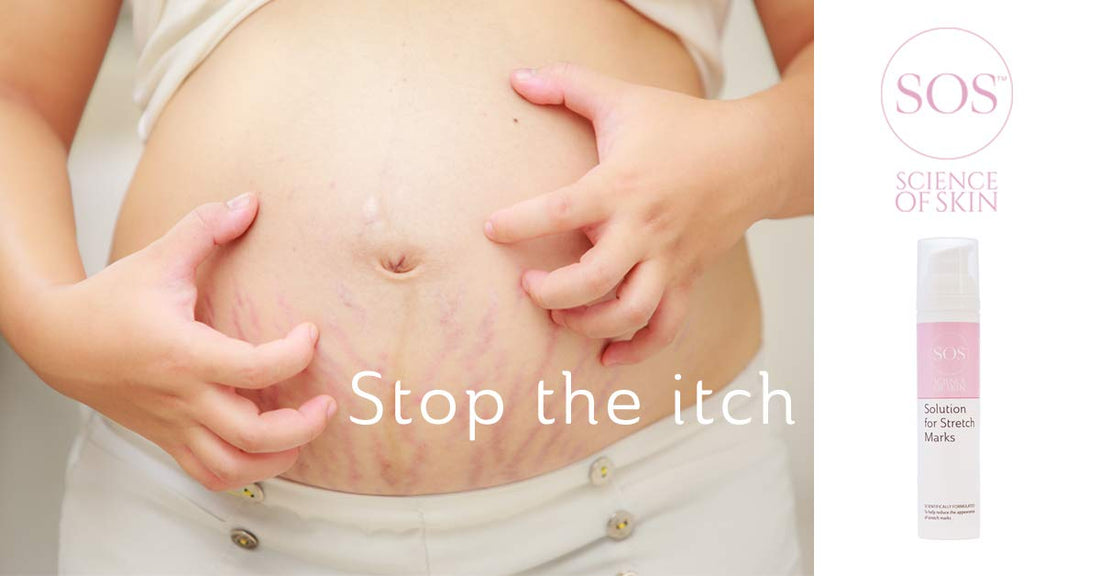 SOS Science of Skin Solution for Stretch Marks
