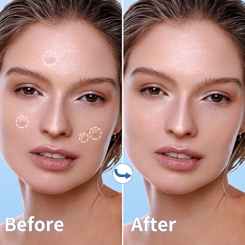 Daolyo Pimple Patches for Face, 4 Size 300 Counts Acne Patches, Hydrocolloid Patches for Covering Zits and Blemishes, Spot Stickers with Salicylic Acid, Tea Tree Oil & Calendula Oil