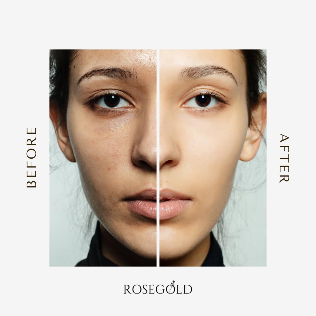 ROSEGOLD KOREAN SKINCARE Snail Mucin Ultimate Power Essence 3.38 fl.oz 100ml, Hydrating Serum with Snail Secretion Filtrate for Glassy and Glowy Skin