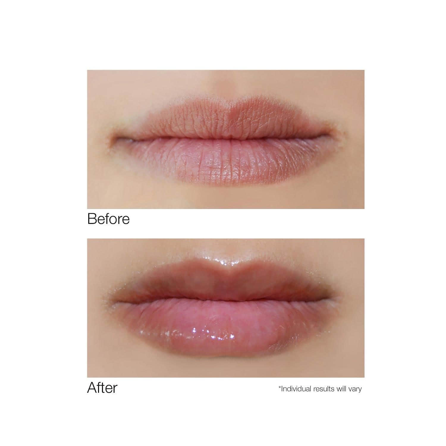 DERMELECT - Smooth Lip Volumizer (0.24 Ounces)