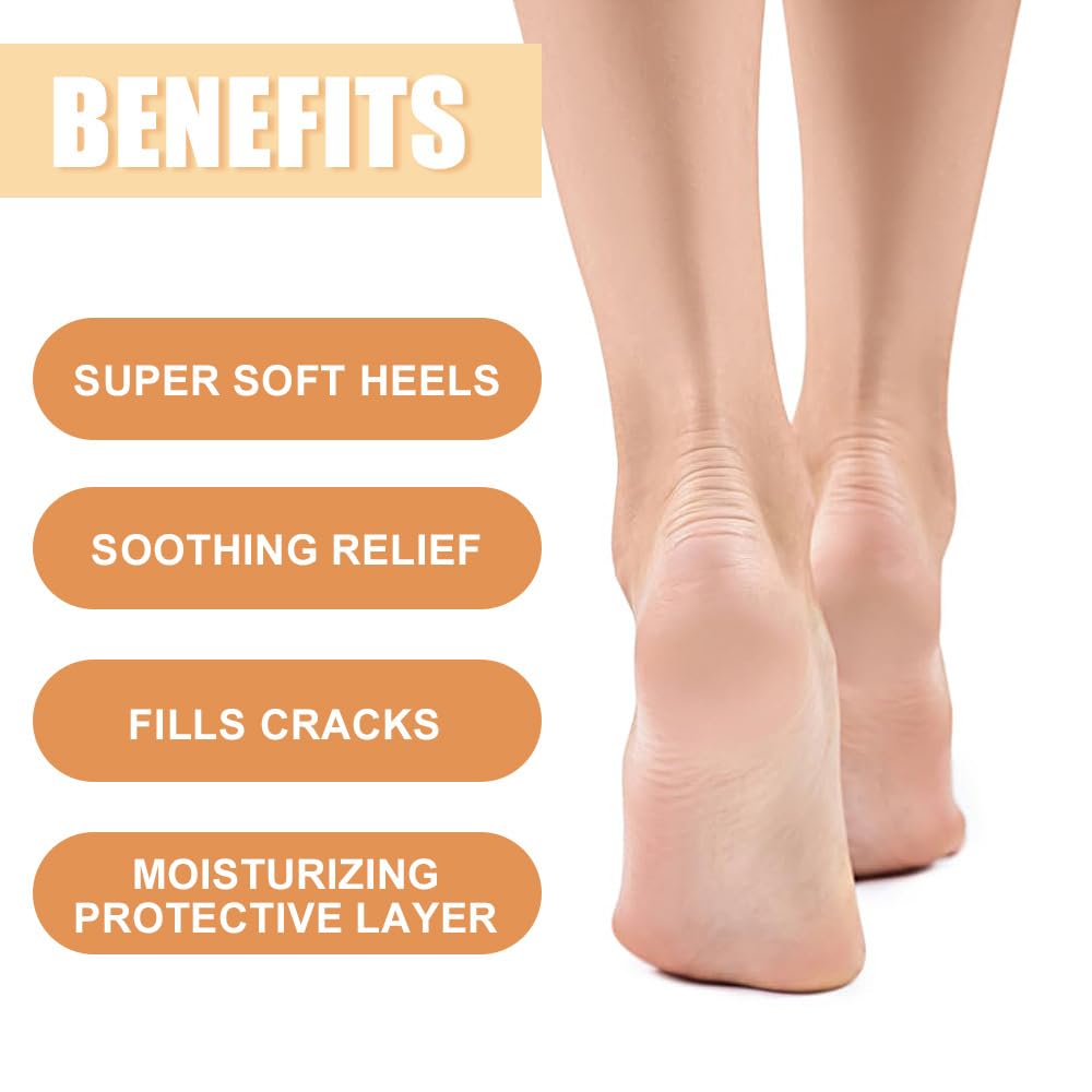 60% Urea Cream - Manuka Honey Foot Hand Cream Stick for Dry & Cracked Feet Elbows Knees Heels Hands, Hydrates & Nourish Foot Care for Softening and Moisturizing, Removing Calloused Skin, 1.41 oz