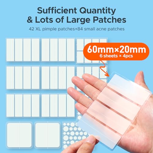 TKTK Large Pimple Patches for Face, 7 Sizes XL Acne Patches, Big Hydrocolloid Bandages for Body, Chin, Forehead, Chest, Back Zit Breakouts, Hydrocolloid Patch (Strip, Square, Dot 126 Count)