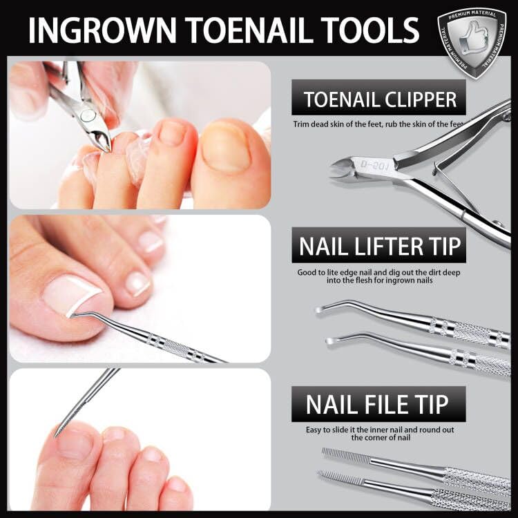 Teenitor Ingrown Toenail Removal Kit, Stainless Steel Ingrown Toenail Clippers, Ingrown Toenail File and Lifters, Ingrown Toenail Treatment, Pedicure Tools For Feet