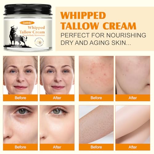 ISUNRISE Beef Tallow for Skin, Tallow Face Moisturizer, Natural Grass-Fed Grass Finished Beef Tallow and Honey Balm Deeply Moisturizing for Face & Body, 2.1 oz