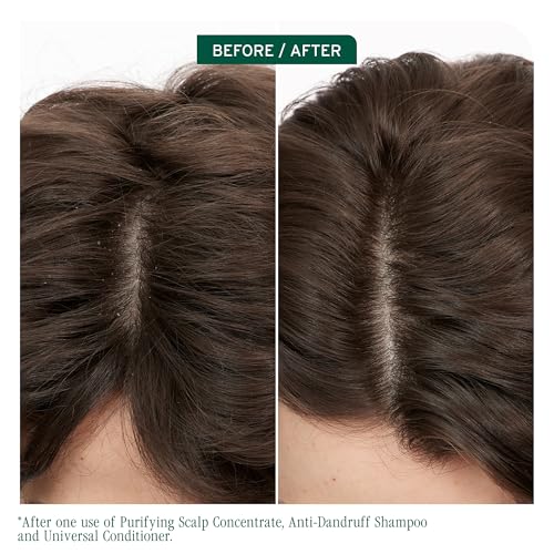 Biolage Scalp Sync Anti-Dandruff Shampoo - Controls Dandruff & Deeply Cleanses, With Zinc Pyrithione, Vegan & Cruelty-Free, 16.9 Fl Oz, Packaging may vary