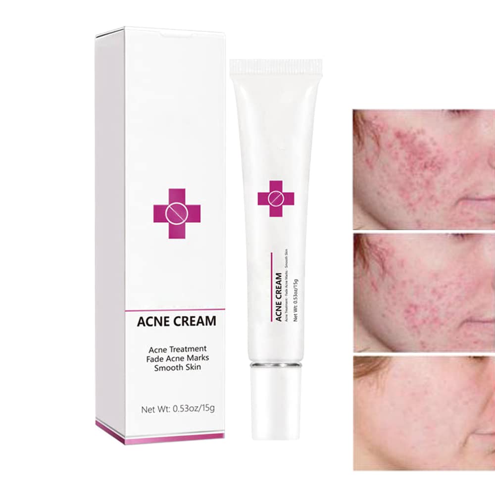 Acne Cream Pimple Cream for Face, Oil Control Pimple Remover Cream Get Rid of Pimples Fast,for Oily and Acne Prone Skin, Cruelty Free, Crema para espinillas en la cara