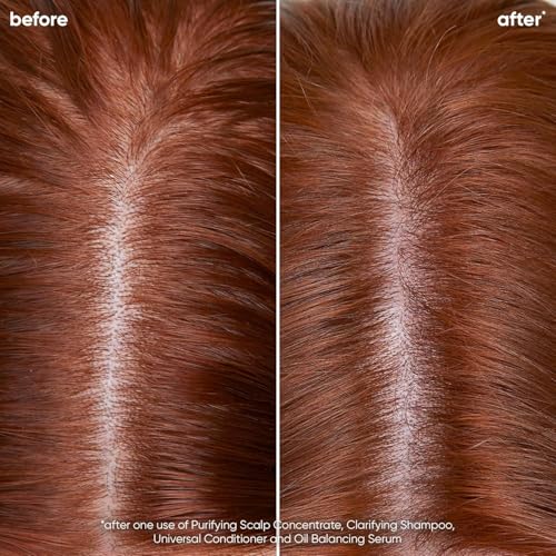 Biolage Scalp Sync Clarifying Shampoo - Residue & Buildup Remover, For Oily Scalp, Fermented Tea & Glycolic Acid, Vegan & Paraben-Free, 13.5 Fl Oz, Packaging May Vary