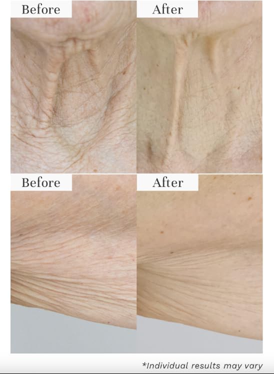 City Beauty InvisiCrepe Body Balm - Skin Firming & Tightening Lotion for a Smoother, Firmer Look | Anti-Aging Firming Body Lotion & Body Cream