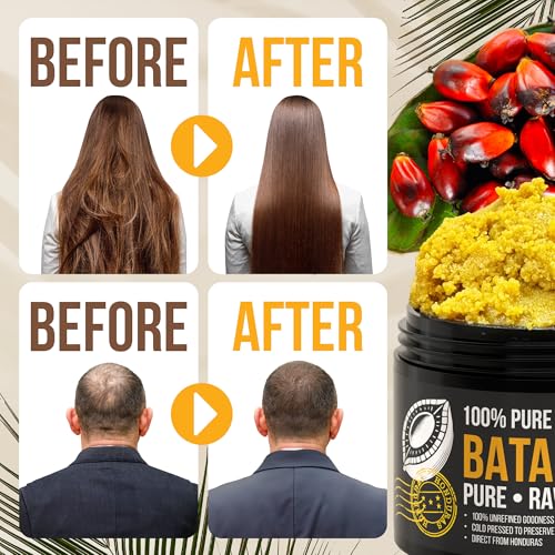 Vie Naturelle 100% Pure Batana Oil for Hair Growth from Honduras – Organic Raw Unrefined – Natural Moisturizer for Skin & Hair – Traditionally Cold-Pressed from Honduran Palm Nut