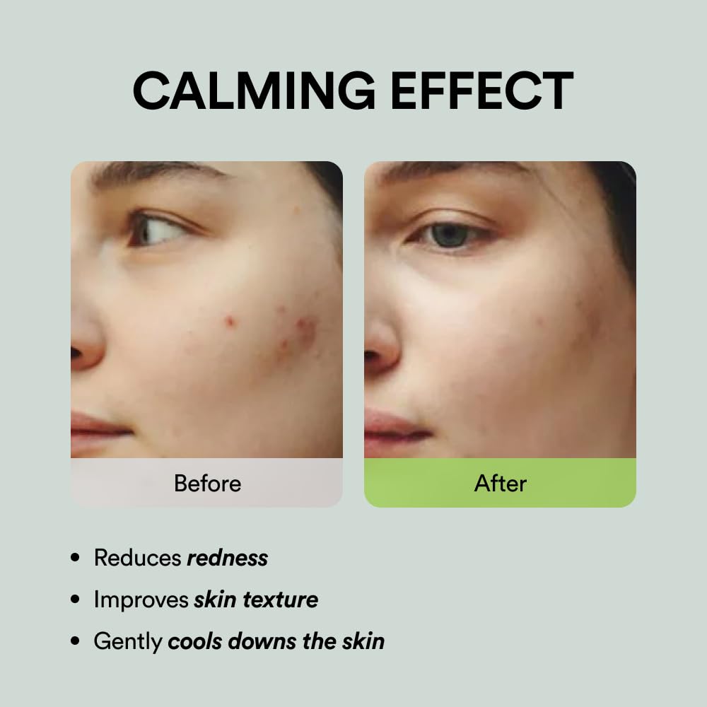 Abib Heartleaf Spot Pad Calming Touch 80pads 5.07 fl.oz. | Korean Acne Soothing Toner Pads for Face, Cleansing, Disposable, Exfoliant, Skin Care