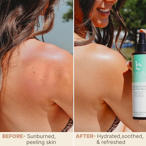 Beauty by Earth After Sun Cooling Aloe Vera Spray - USA Made With Organic Aloe Vera, Fast Absorbing After Sun Care for Sunburn Relief, Skin Cooling Spray, Sunburn Treatment Spray Lotion for Body