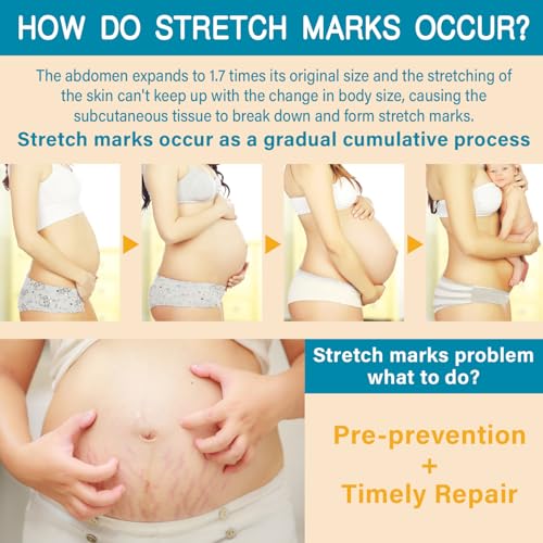 PEGO Stretch Mark Oil for Pregnancy, Maternity Body Oil for Stretch Mark Prevention & Reduction, Hydrating Skin Care, 4.06oz (2Pack)