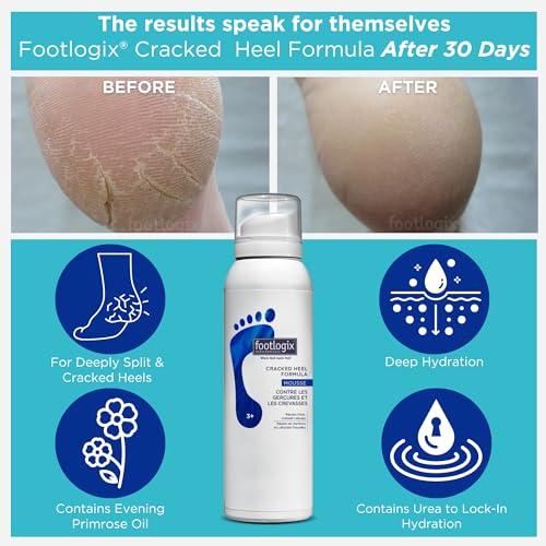 Footlogix Cracked Heel Formula, 125ml