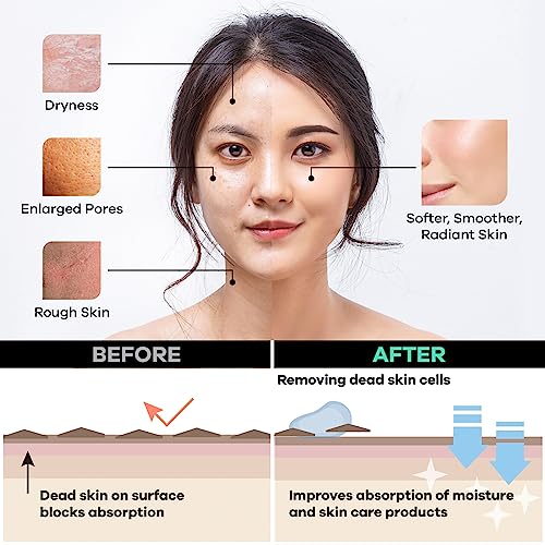 Dermasuri Deep Exfoliating Face Mitt - Scrubber, Dead and Dry Skin Remover for Men and Women - Exfoliator Gloves for Shower and Dry Use - (2 Pack)