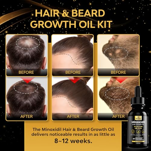 beaueli Minoxidil for Men Beard Growth Kit, Minoxidil for Women Hair Growth Kit, Hair Loss Treatments for Women Hair Regrowth Treatment, Minoxidil 5%, Black
