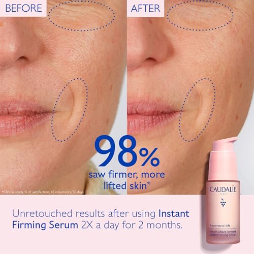 Caudalie Resveratrol-Lift Instant Firming Retinol Alternative Serum, Refillable - 30 mL
