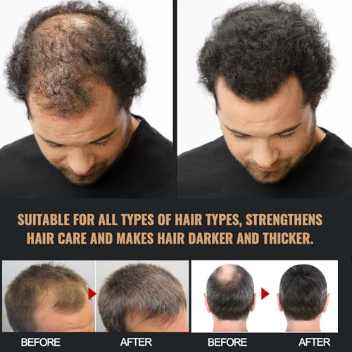 Spartan Shampoo, Spartan Root Activator Shampoo, Natural Hair Regrowth Shampoos for Men Women 2bottles (100ml/1 Bottles)