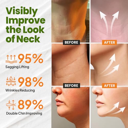 Neck Cream for Tightening Firming: Instant Face Lift Cream - Wrinkle Cream for Women- Anti Wrinkle Cream with Retinol Collagen & Hyaluronic Acid - Lifting, Firming & Hydrating - 1.7 FL OZ