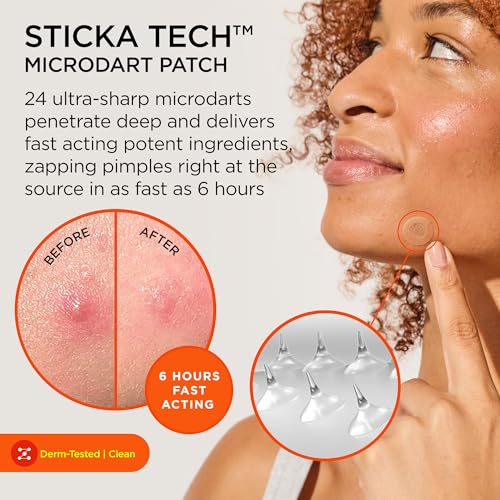 ZitSticka Killa Acne Patches for Face - World's Most Potent Pimple Patch with Fast-Acting Microdarts - Starts Working within 2 Hours for Deep, Early-Stage Zits - 20 Count