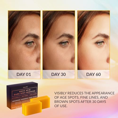 VALITIC Kojic Acid Dark Spot Remover Soap Bars with Vitamin C, Retinol, Collagen, Turmeric - Original Japanese Complex Infused Hyaluronic Acid, E, Shea Butter, Castile Olive Oil (4 Pack)