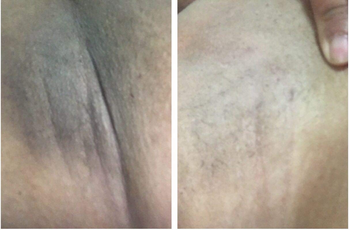 Oriental Princess Underarm Care Pure White Secret Cream 50 g.White armpit cream