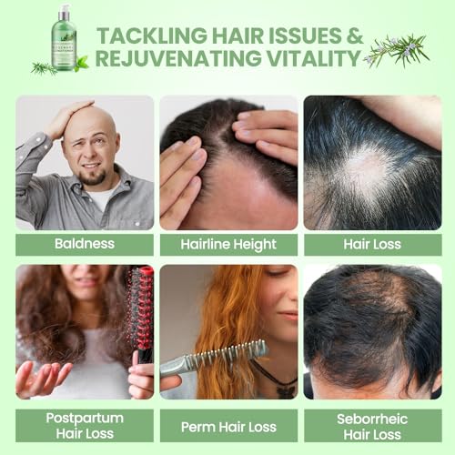 Rosemary Conditioner for Hair Growth: Conditioner for Thinning Hair & Anti-Hair Loss for Men and Women - Rosemary Mint Strengthening Conditioner with Tea Tree Oil Biotin