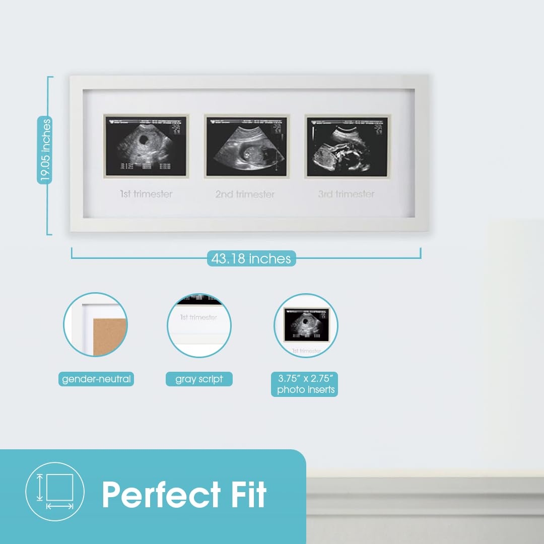 Pearhead Sonogram Progression Frame - Trimester by Trimester Pregnancy Milestone Keepsake, Gender-Neutral Nursery Decor, Displays 1st, 2nd & 3rd Trimester Ultrasound Photos, White