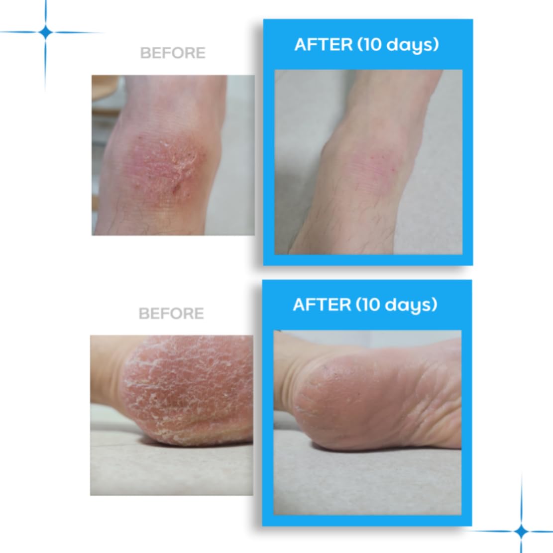 LE PURS AMIS Organic Shea Butter Moisturizing Lip balm, Multi-purpose, Nourishing, Hydrating, Chemical-free, Non-toxic, Shea butter Scent (10, Grams), Dry Skin, Dryness, Korean