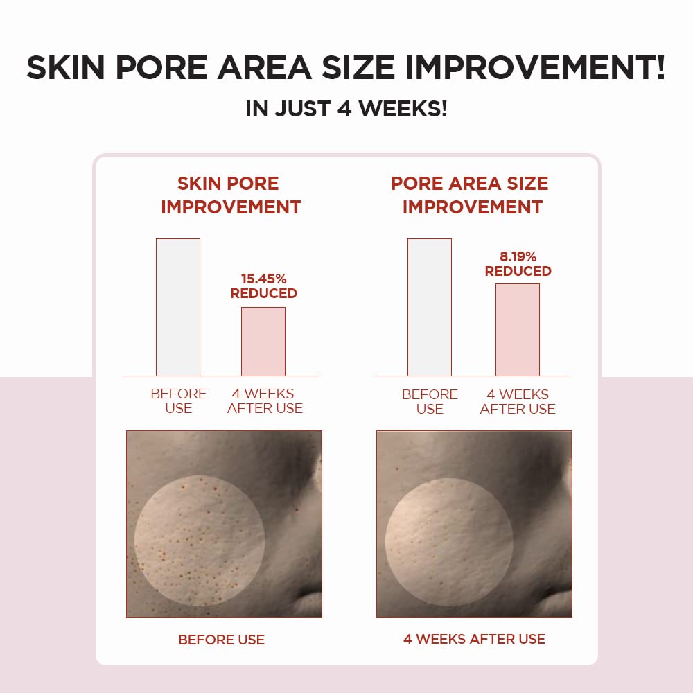 SKIN1004 Madagascar Centella Poremizing Clear Toner 7.1 fl.oz, 210ml for Keratin Plug and Sensitive Skin