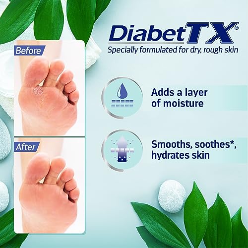 Goicoechea Diabet TX Body Lotion for Diabetic Dry Skin, Hydrating Diabetic Skin Cream for Women and Men, Diabetic Moisturizer for Hands, Legs, and Body, Extra Dry Skin Relief, 13.5 Oz