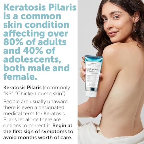 Keratosis Pilaris Treatment | Keratosis Pilaris Lotion | KP Lotion | Gentle Exfoliation For Strawberry Legs, KP & Ingrown Hairs | Smooth & Hydrating Body Lotion For Redness, Dry, Rough And Flaky Skin