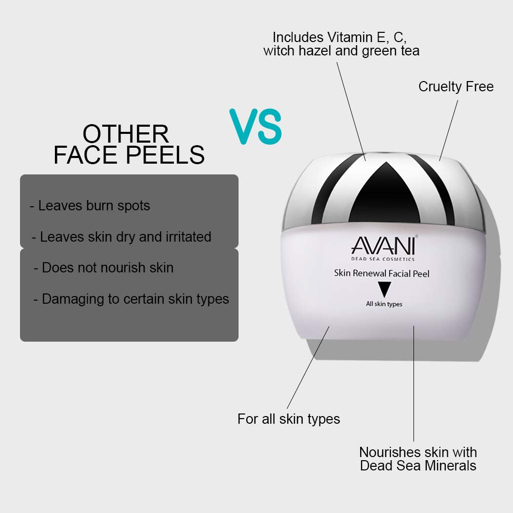AVANI Skin Renewal Facial Peel, 1.7 fl. oz. 70% larger, better packaging