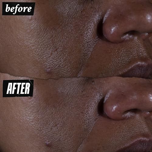 Kiehl's Ultra Pure High-Potency 9.8% Glycolic Acid Serum, Concentrated Face Serum to Exfoliate for Glowy Skin, Visibly Smooths Skin Texture & Boosts Skin Glow, All Skin Types, Fragrance-free - 1 fl oz