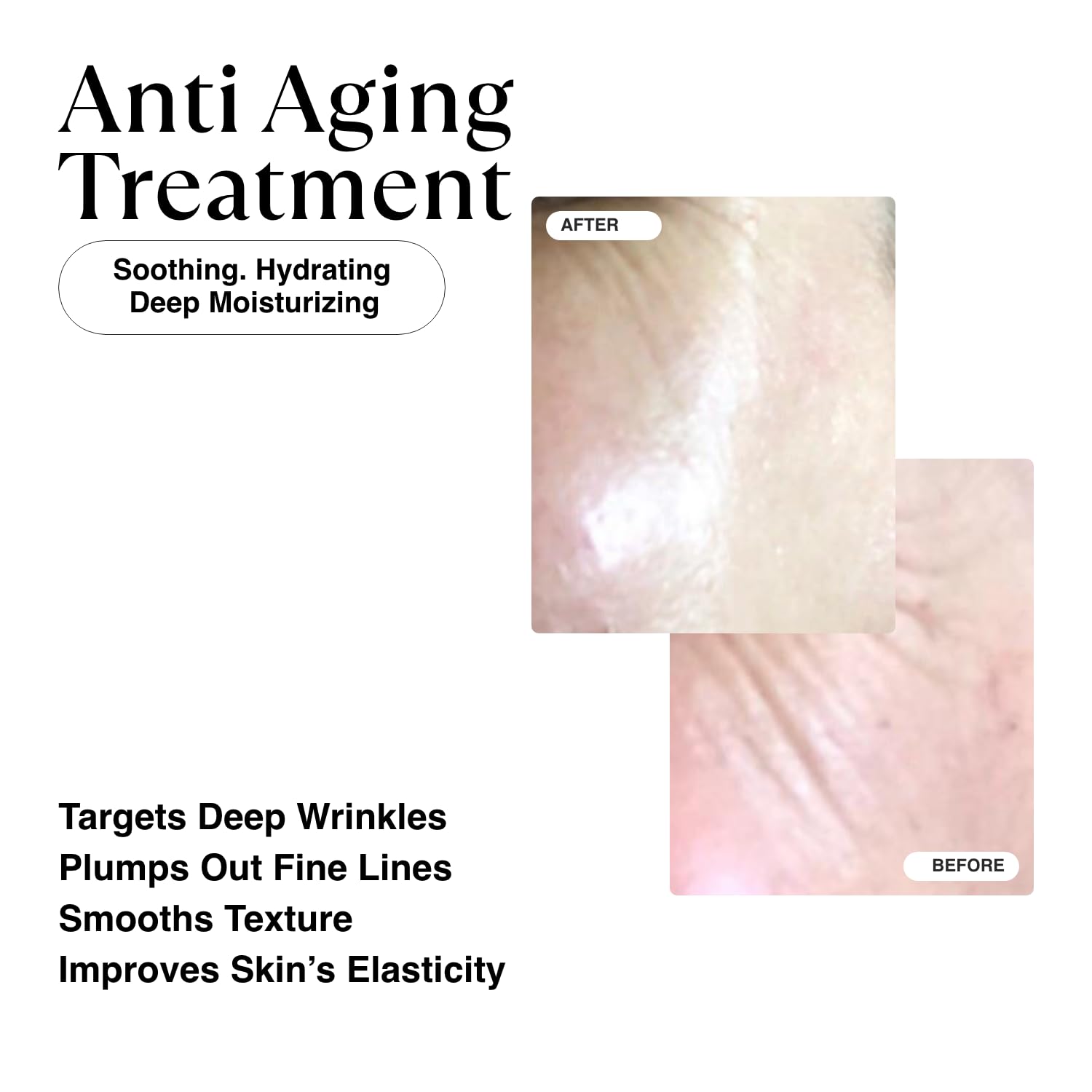 MATKAS Korean Active Capsule 0.05% Retinal Hybrid Cream 1.7 Fl. Oz. - Korean Skin Care Night Cream, Skin Care Moisturizer for Anti Aging Wrinkle Repair, 2% Niacinamide Retinaldehyde Serum for Face