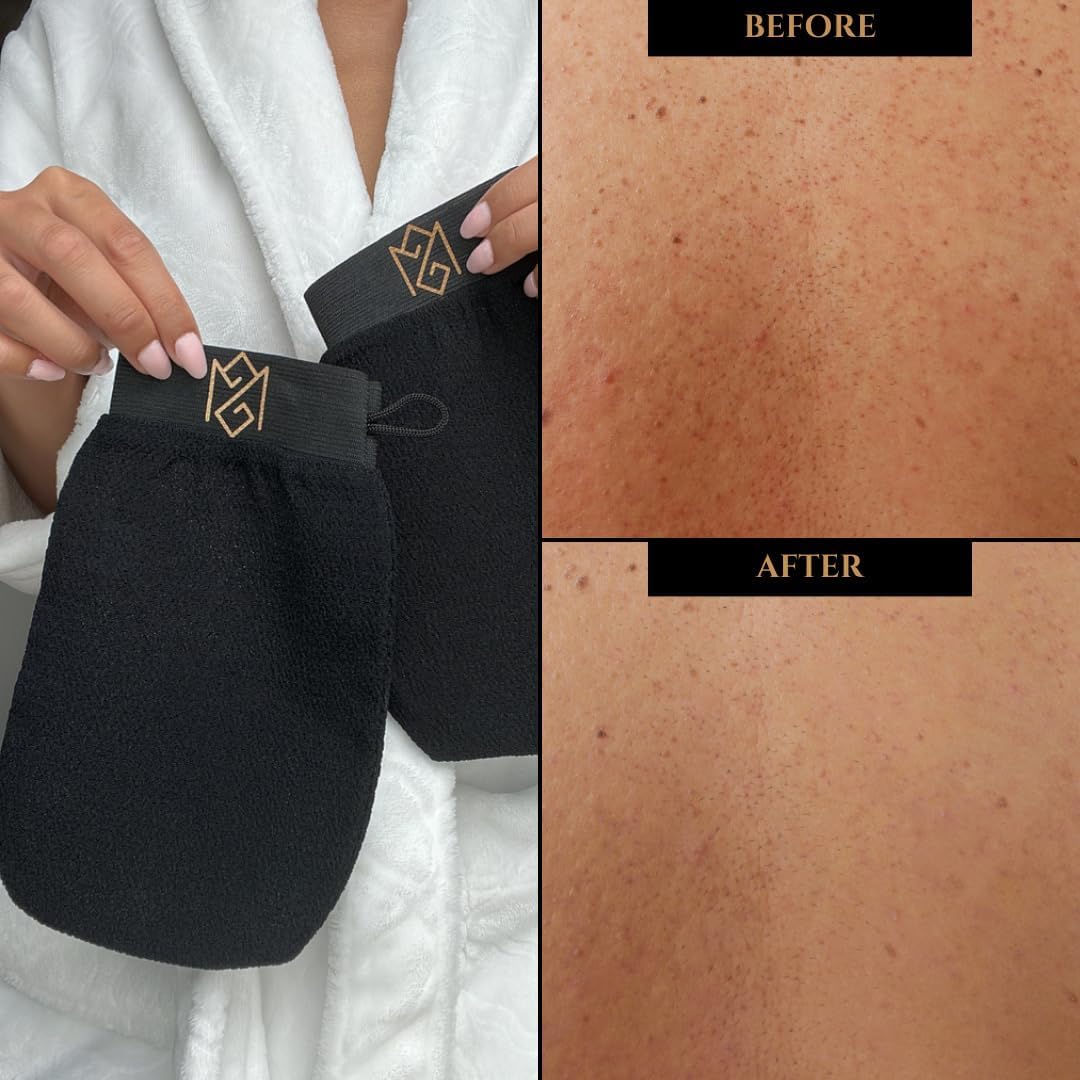 Exfoliating Glove Kessa Mitt Body Scrubber - Dead Skin Remover Shower Glove for Dead Skin Scrubbing and Deep Pore Cleansing - by MoroccanSource (3 piece spa set)