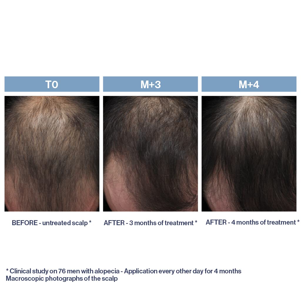 PHYTO PARIS Phytolium+ Treatment, 3.38 fl. oz.