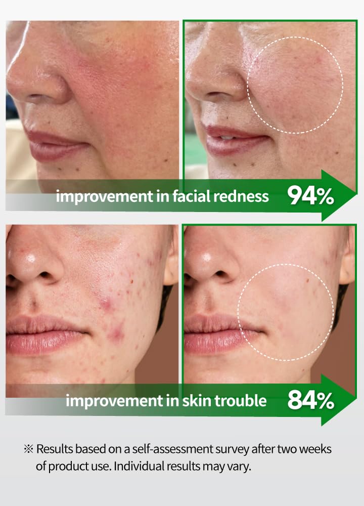 BEAUDIANI CICA ampoule mask 100ea, Skin Care pad, Korean Toner Pads, centella asiatica Toner pad, Hydrating, Facial Essentials, Quick Calming, Reduce hot Flush, Nutrition for Irritated Skin