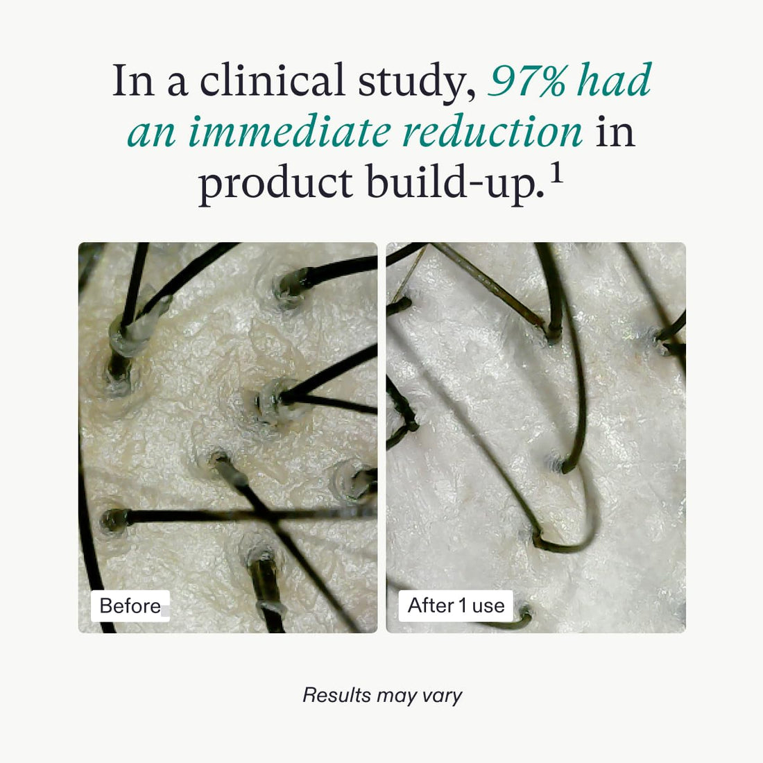 Nutrafol Exfoliating Scalp Mask, Eliminates Product Build-up and Oil for Healthier Hair and Scalp, Physician-formulated for Thinning Hair, Color and Extension Safe - 4 Fl Oz Bottle