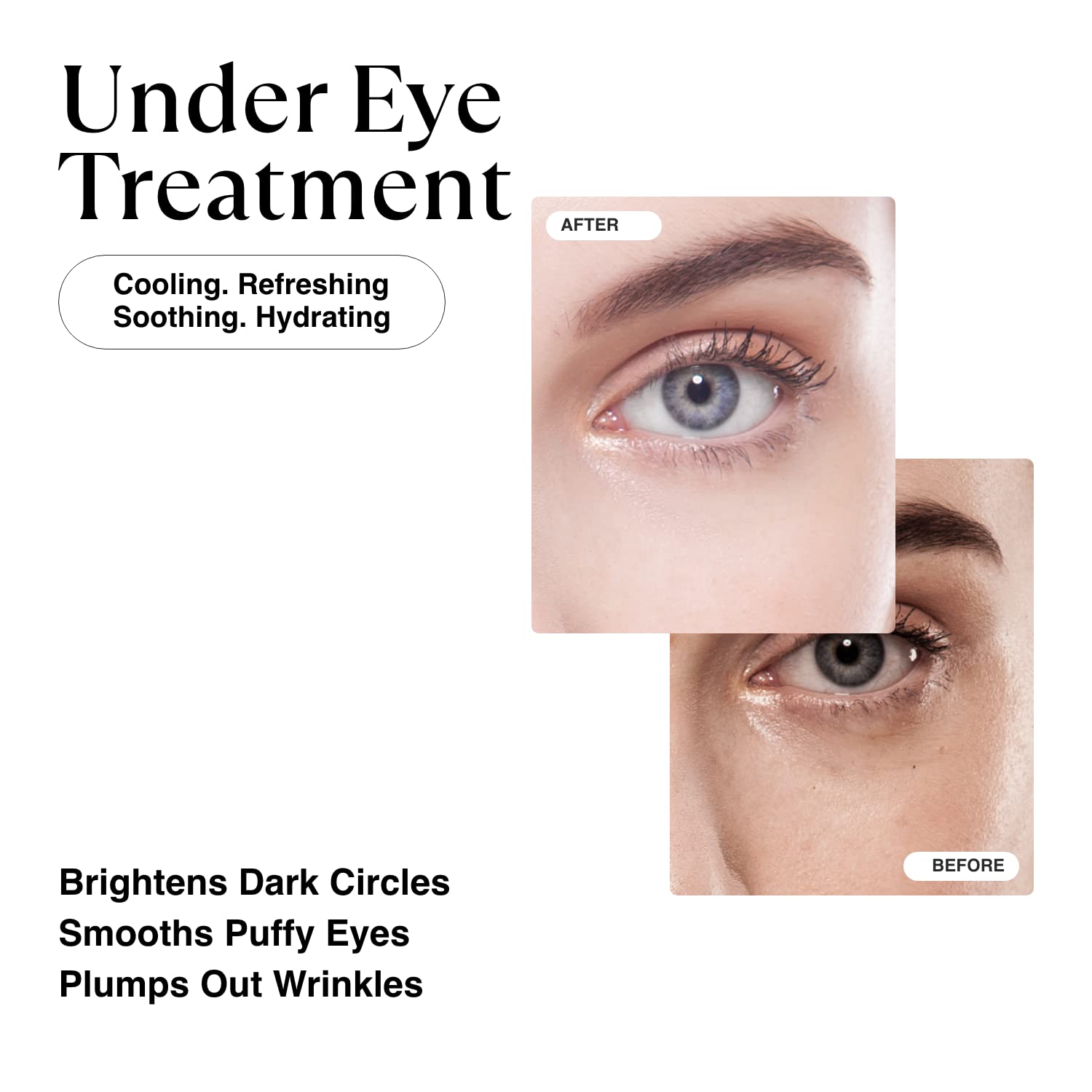 MATKAS Korean Gold Under Eye Patches for Dark Circles and Puffiness, Wrinkles - Retinol + Hyaluronic Acid + Collagen + Niacinamide, Under Eye Mask Puffy Eyes Treatment for Women Skin Care