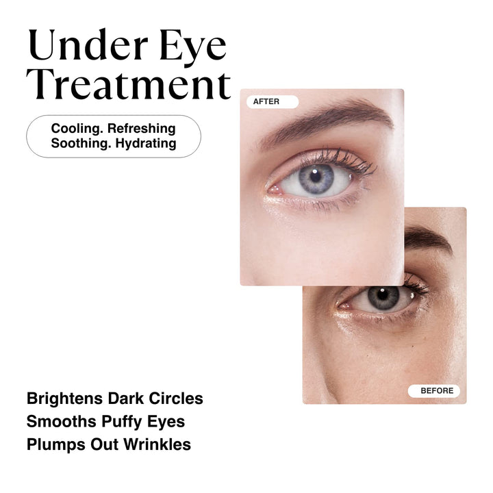 MATKAS Korean Gold Under Eye Patches for Dark Circles and Puffiness, Wrinkles - Retinol + Hyaluronic Acid + Collagen + Niacinamide, Under Eye Mask Puffy Eyes Treatment for Women Skin Care