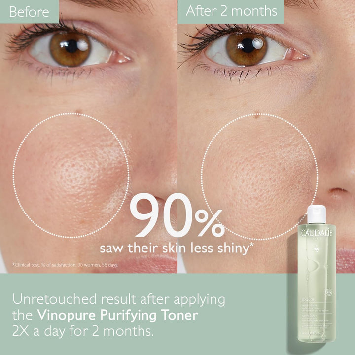 Caudalie Vinopure Natural Salicylic Acid Pore Minimizing Toner, 6.7 Ounce