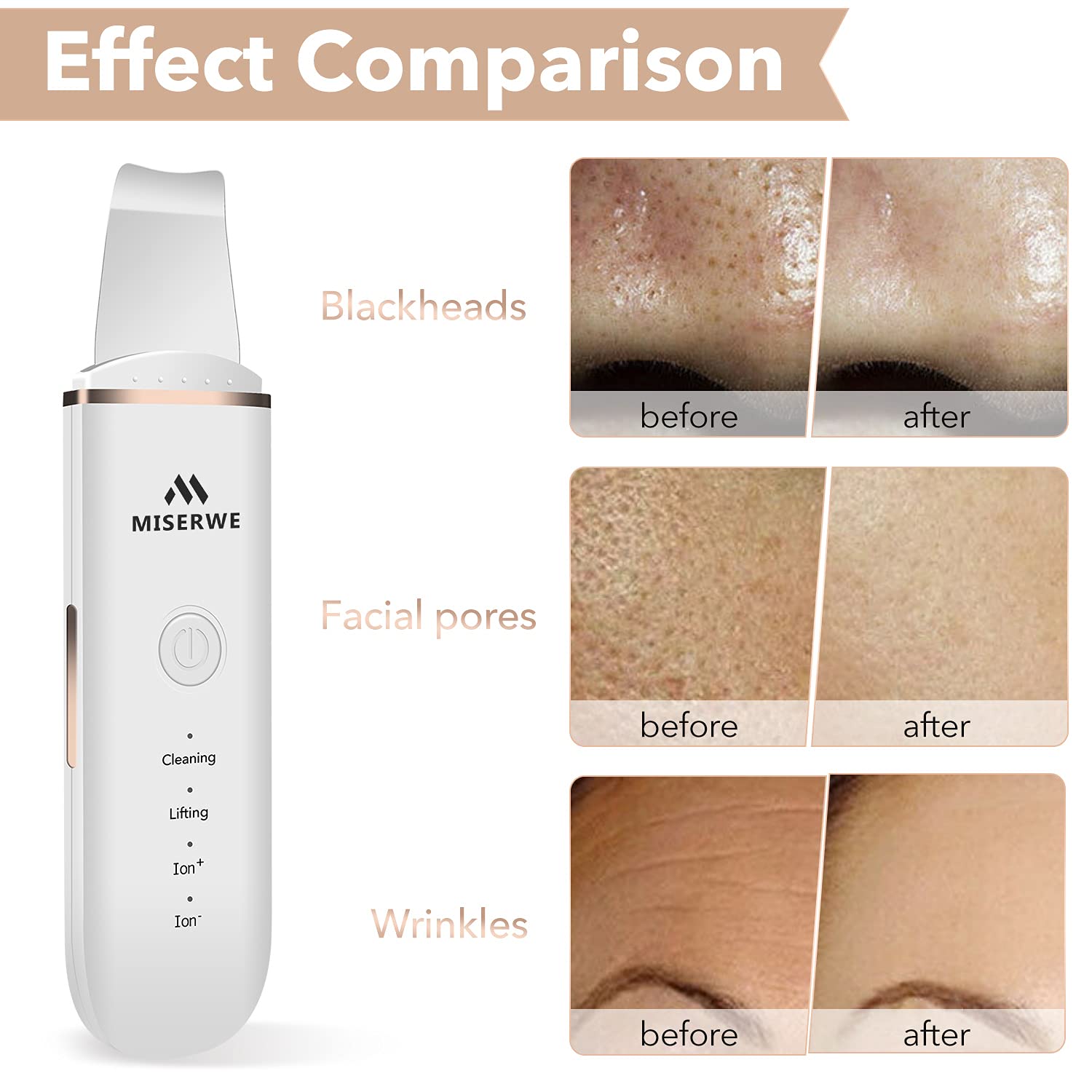 Skin Scrubber Face Skin Spatula Blackhead Remover Pore Cleaner Face Beauty Lifting Tool Comedones Extractor with 4 Modes, Facial Scrubber Spatula for Deep Cleansing With Two Silicone Case