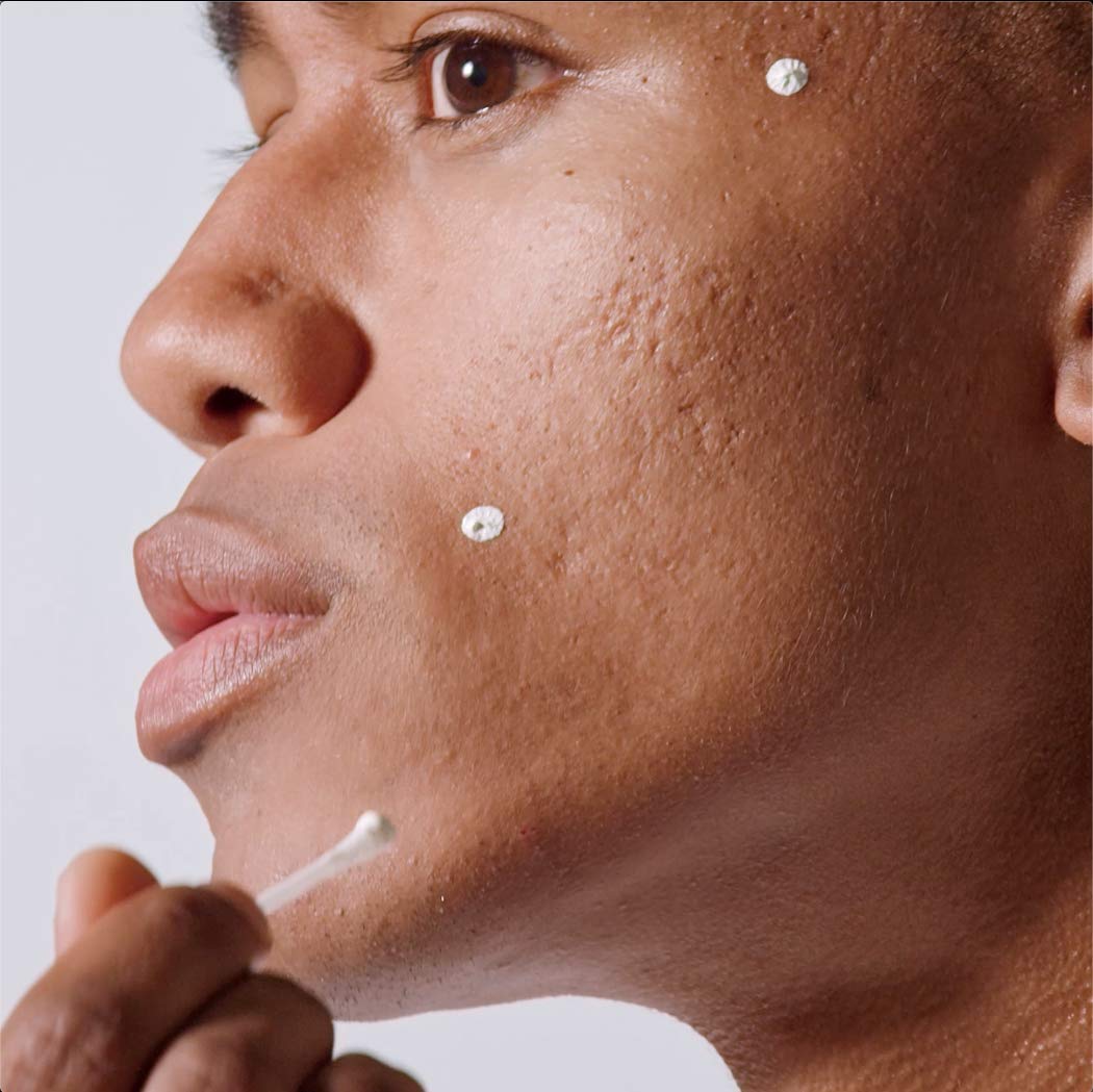 Malin + Goetz Acne Treatment-0.5 oz. by Malin + Goetz