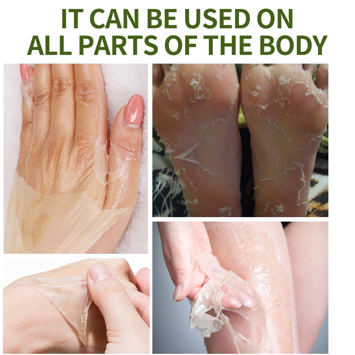 IREV Peeling Oil for Dark Skin, Green Peeling Oil, Facial Peels with Hyaluronate,Exfoliating Peel Solution for Body, Chemical Peel At Home for Dark Spots, Body Exfoliant Peels 3.66 OZ