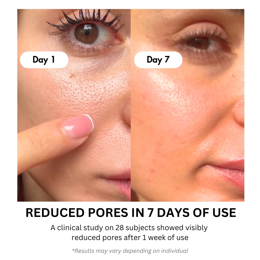 P.CALM RETINOLAGEN AMPOULE | Retinol + Collagen for Pore Tightening, Wrinkles & Fine Lines | Korean Glass Skin Serum (30ml / 1.01 fl. oz.)