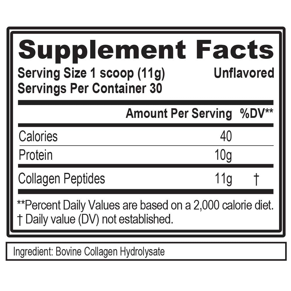 Evlution Nutrition Collagen Peptides Powder, Premium Hydrolyzed Collagen to Support Healthy Skin, Hair, Bones, Joints, Nails & More (30 Servings)